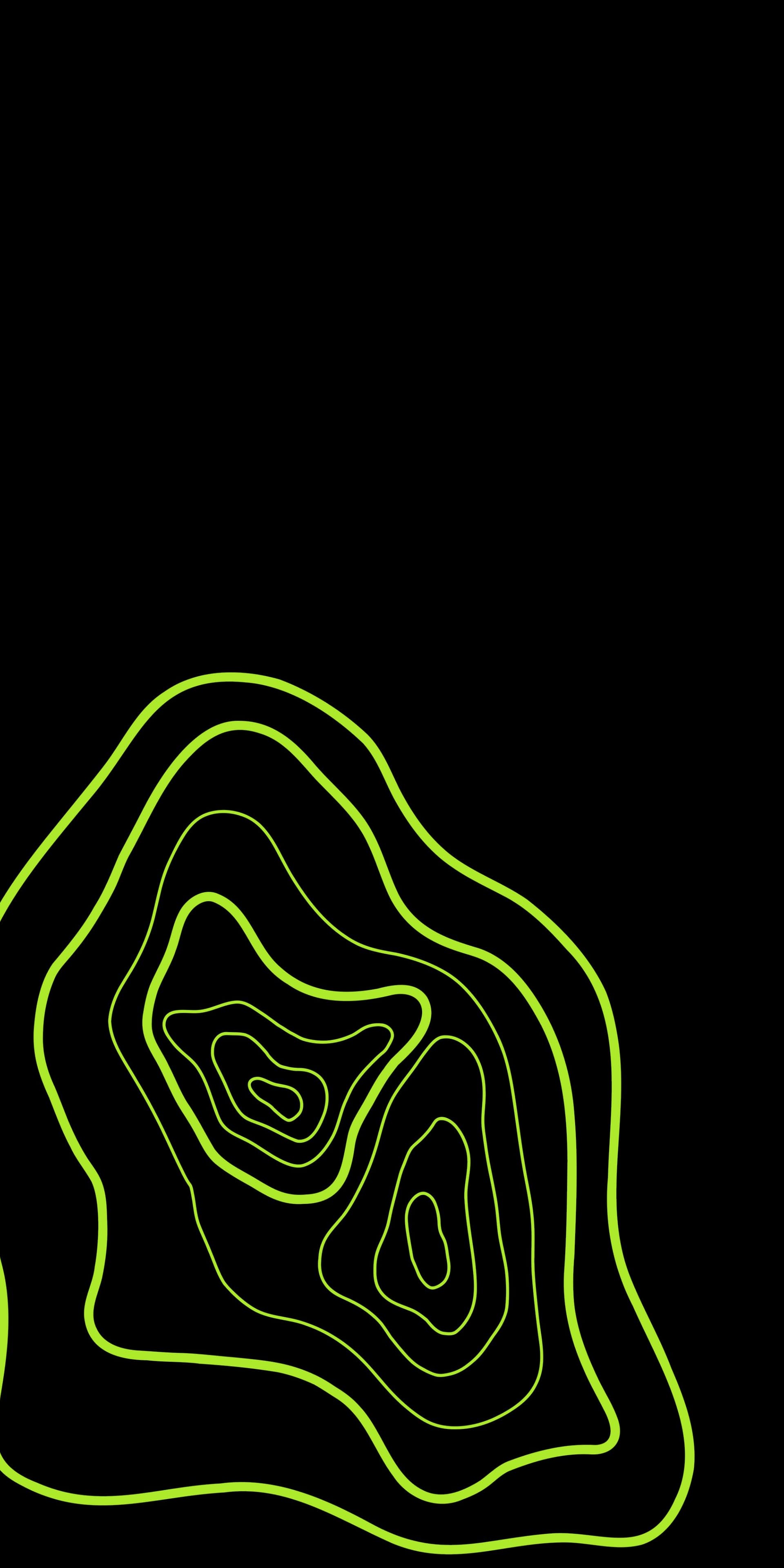 Bone density visualization - early screening saves lives