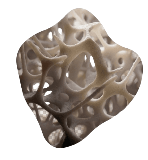 Bone structure analysis
