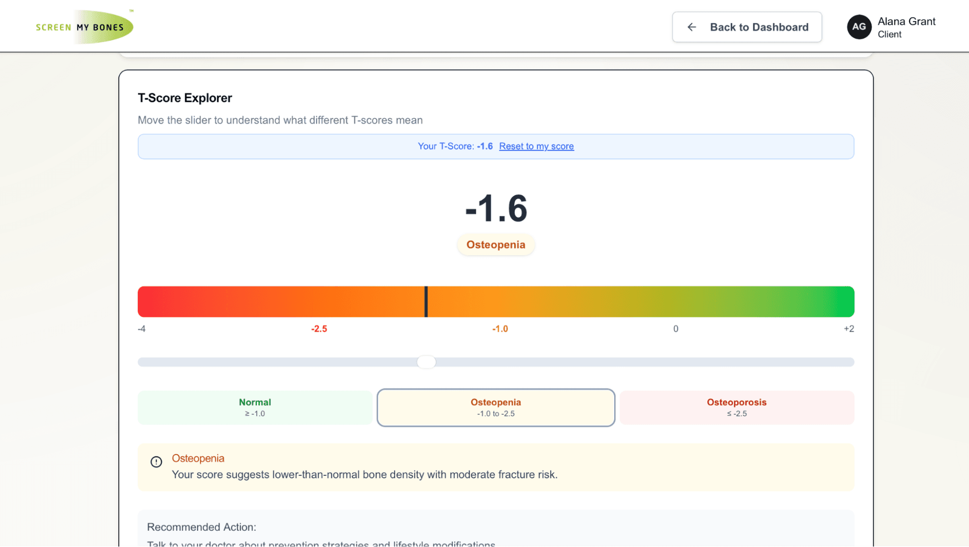 T-Score Explorer screenshot explaining bone density metrics